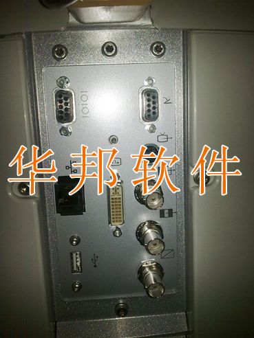 超声工作站、超声工作站软件