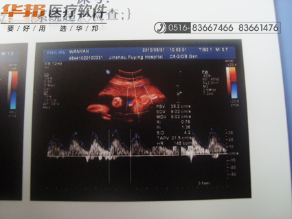 超声工作站软件