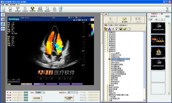 华邦超声工作站软件