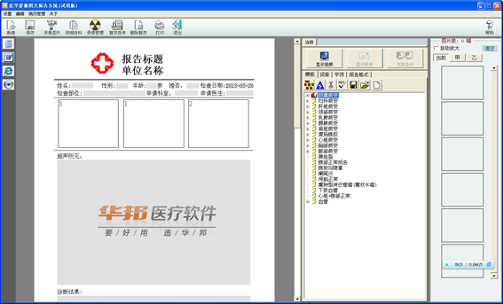 华邦超声工作站软件